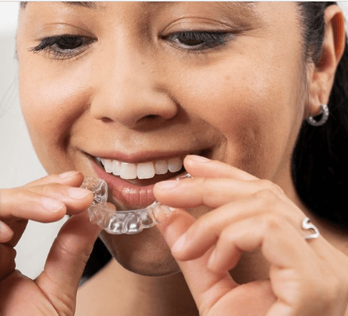 Invisalign Review