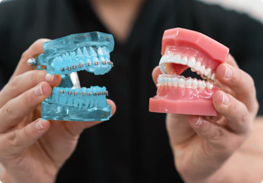 The Bottom Line Invisalign The Bottom Line