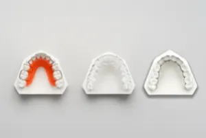  Different types of retainers that you should know.