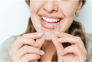 A girl is inserting clear aligners