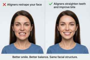 A split-screen comparison of how clear aligners
    change face shape.