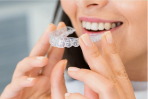 A woman wearing clear aligners
