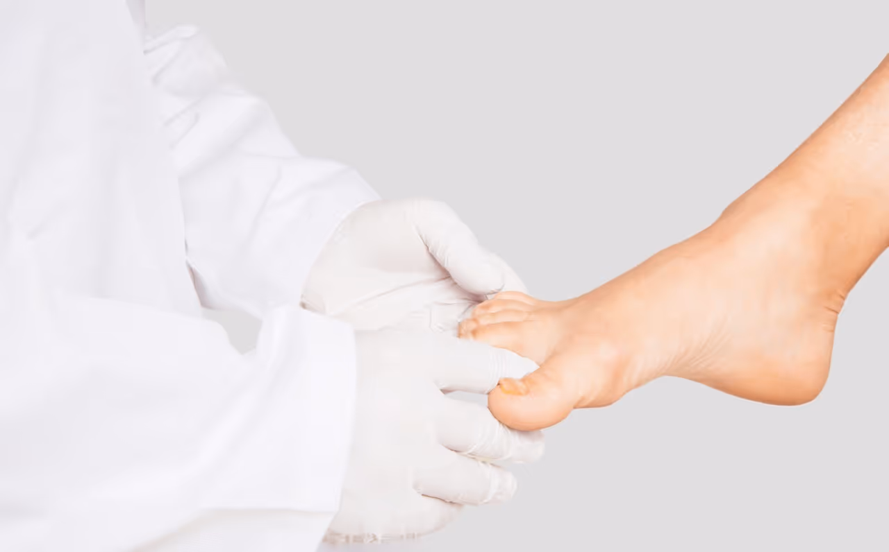 Ein Arzt untersucht die Füße eines Patienten auf Nagelerkrankungen wie Nagelpilz.