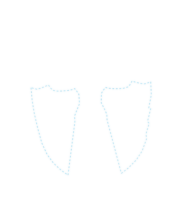 U-zone outline from the face mapping