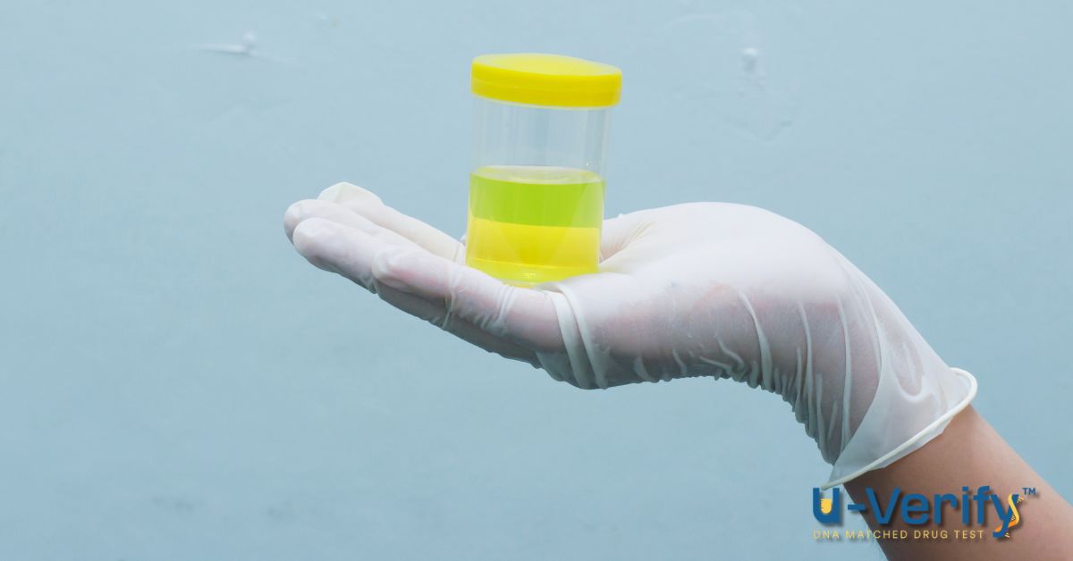 urine alcohol test vs breathalyzer