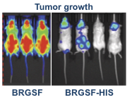 BRGSF Model