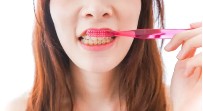  A woman brushing teeth with braces.