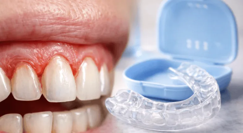 Receding gums and a mouth guard.