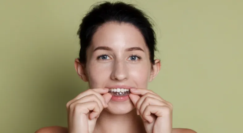  A girl applying clear aligners for at-home teeth straightening.