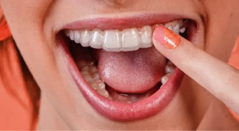 A girl smiling while wearing clear retainers