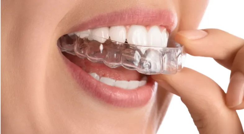 A girl applying clear retainers.