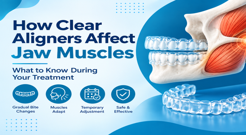 An illustration showing how clear aligners affect jaw muscles 
