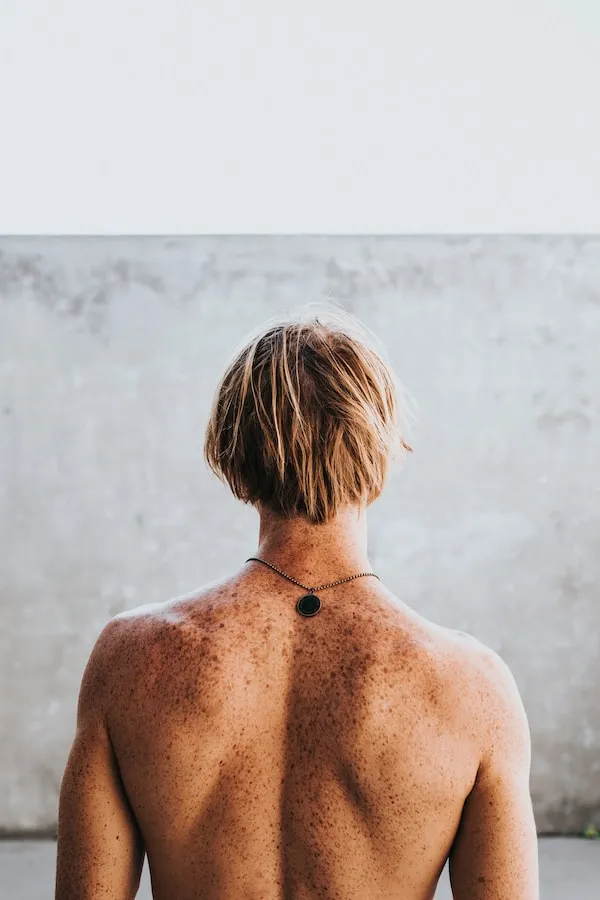 A large number of moles (more than 100) increases your risk of skin cancer