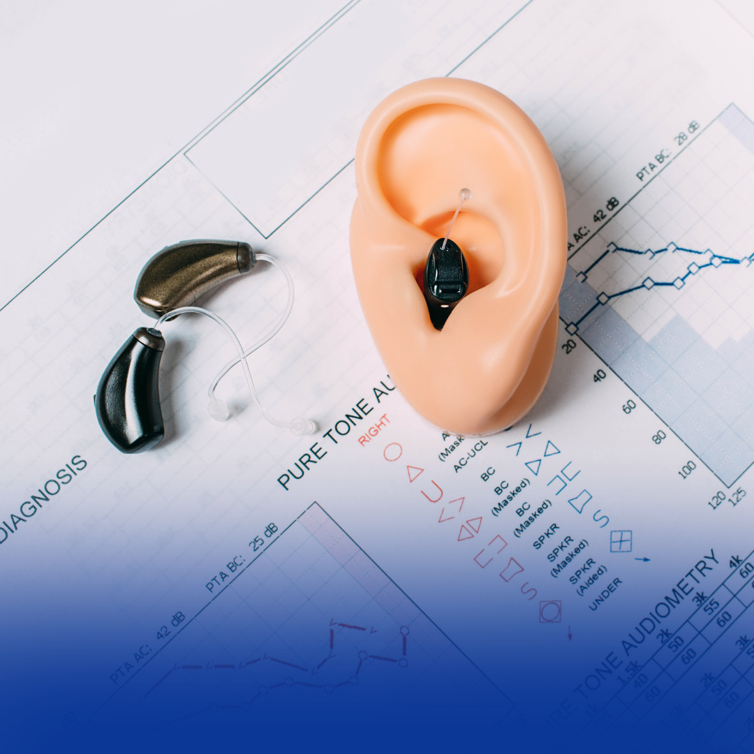 How to Read an Audiogram: A Simple Guide to Your Hearing Test Results