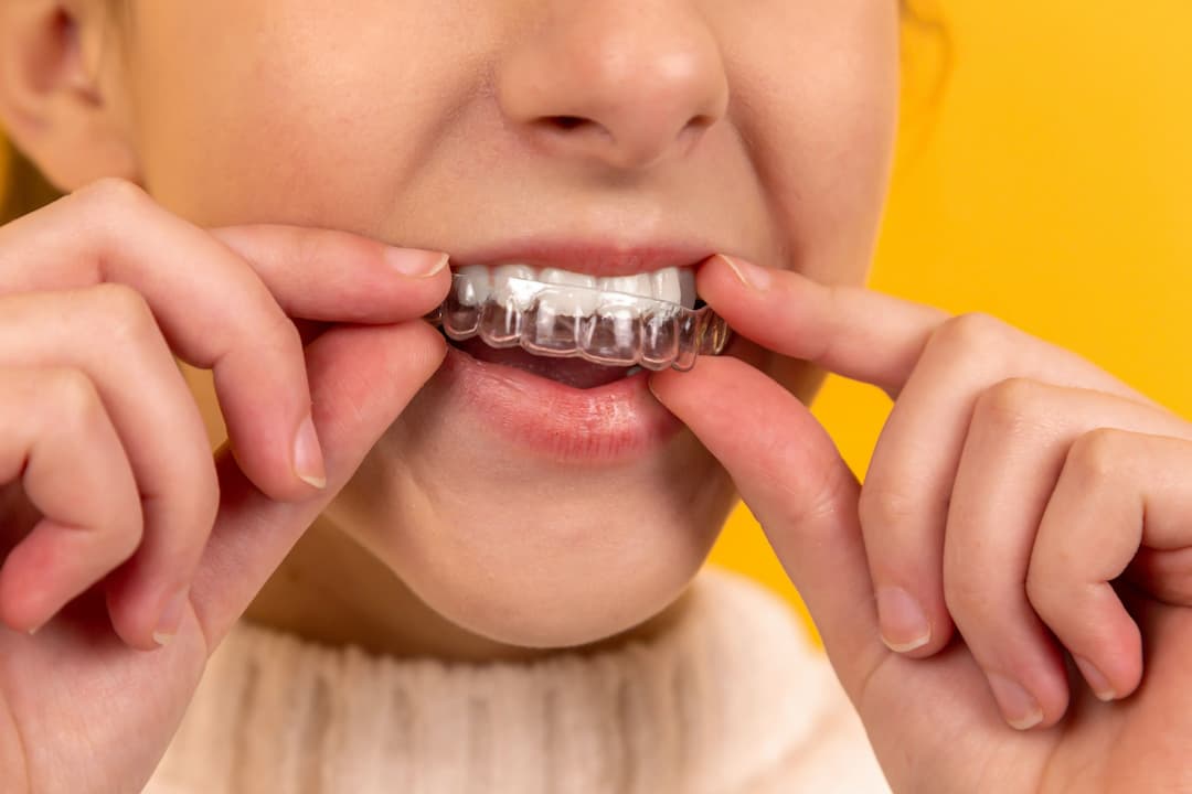 A lady putting in her Invisalign Lite Clear teeth Aligners
