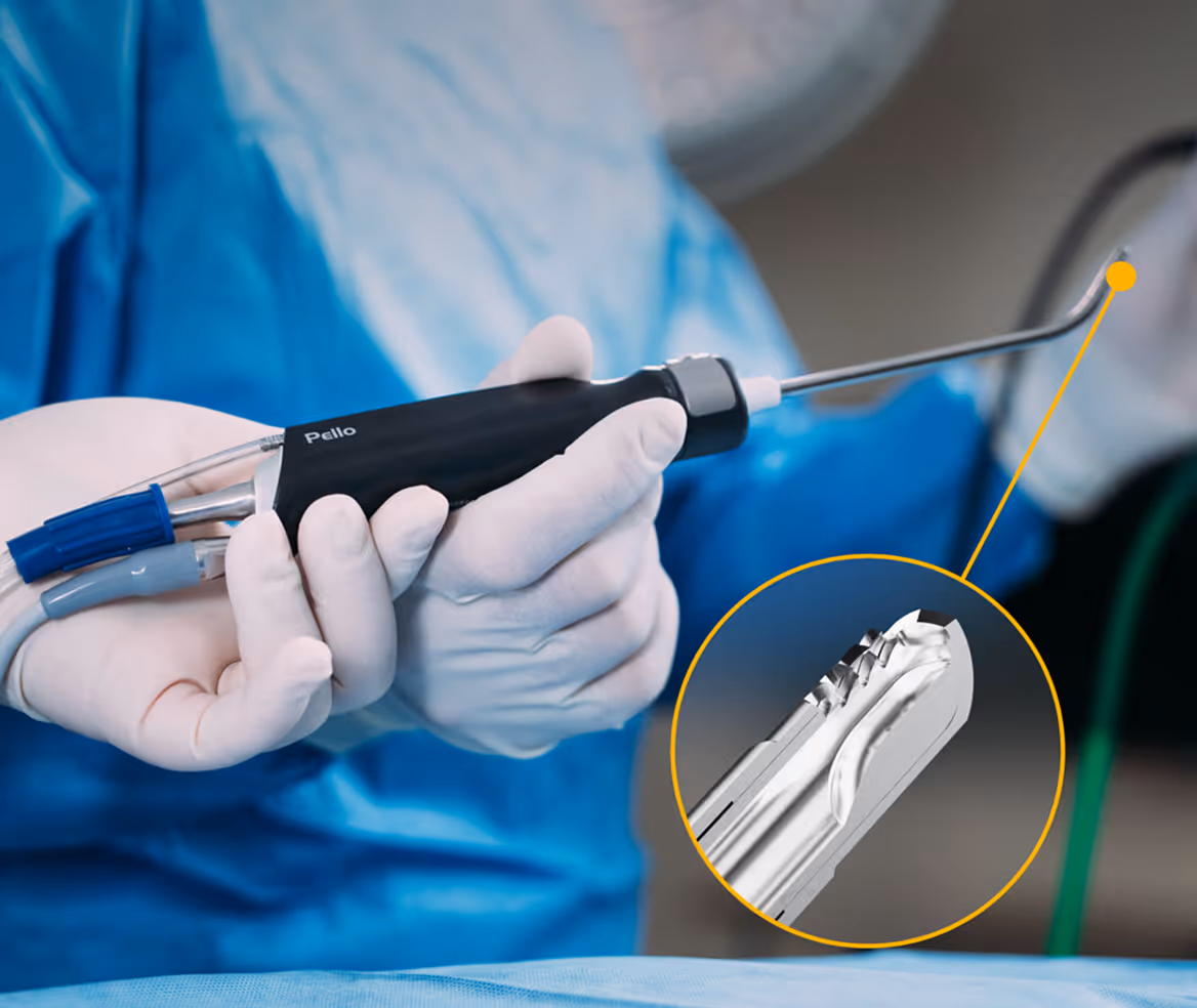 Hand in surgical glove holding a Pella endoscopic medical device with a zoomed-in inset showing detailed tip design.