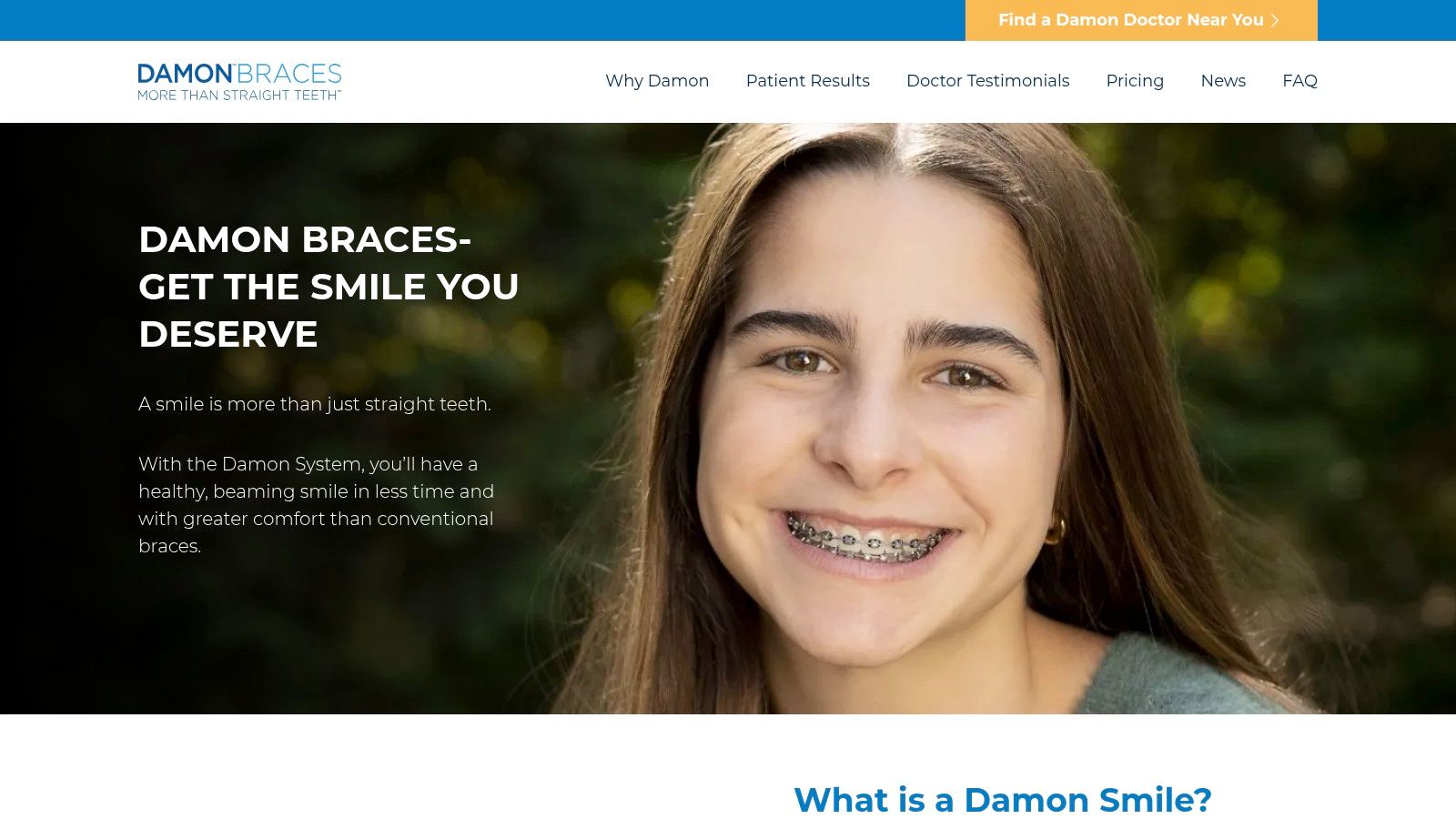 Damon Braces (Ormco)