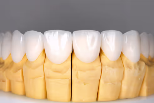 Dental Crowns - Parkway Smiles Dentistry