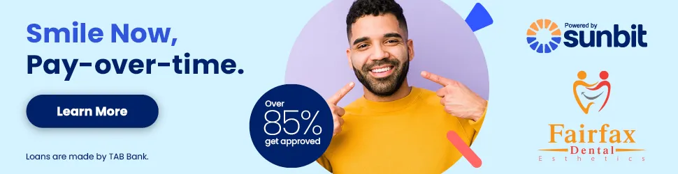 pay over time financing