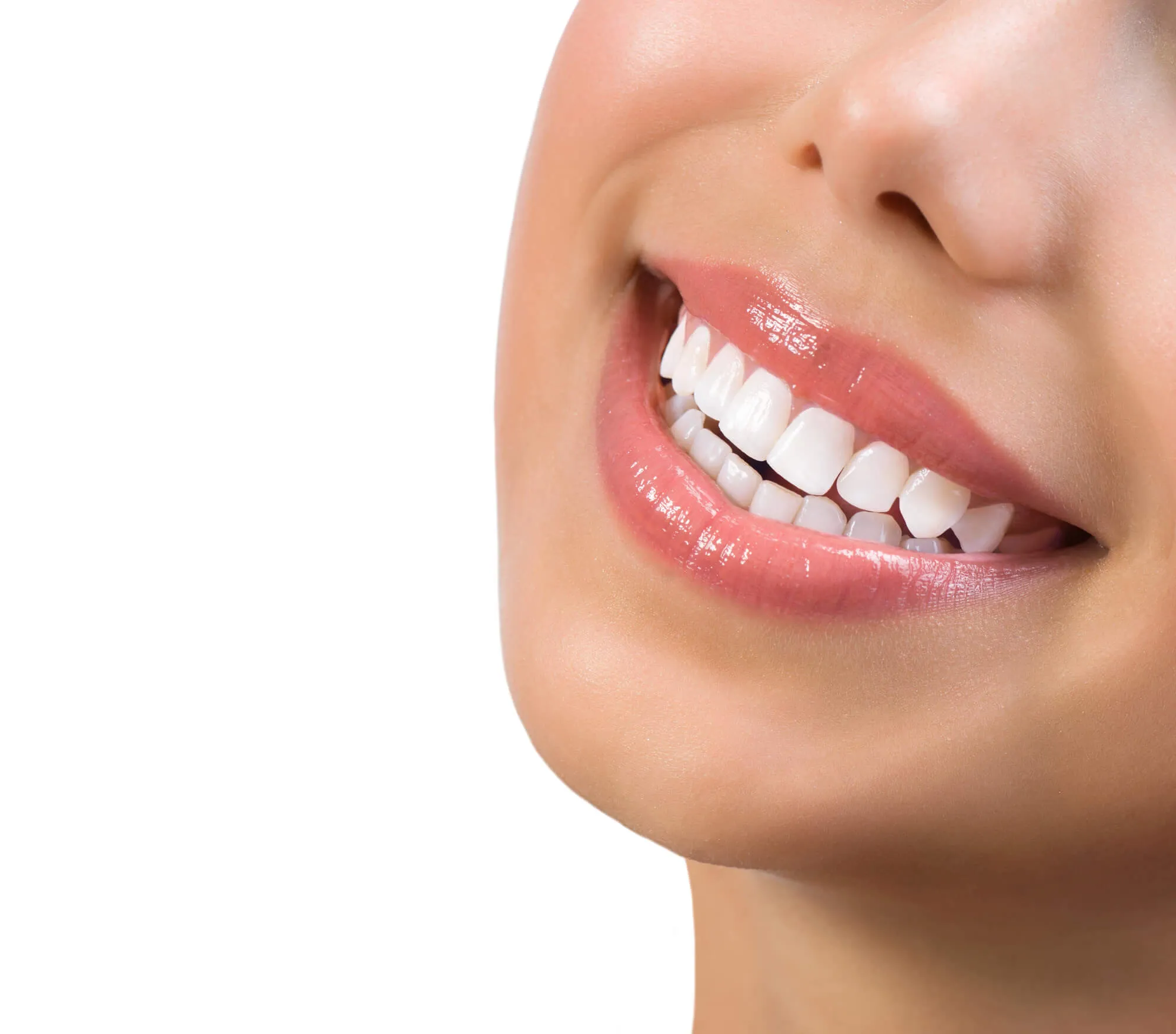 after teeth whitening alexandria va