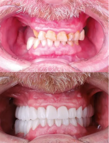 Before After Dental