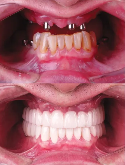 Before After Dental