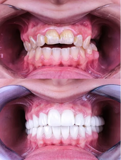 Before After Dental