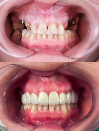 Before After Dental
