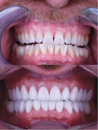 Before After Dental