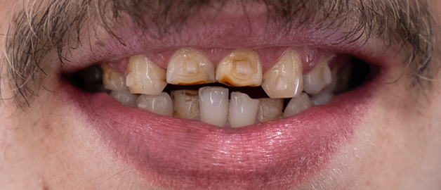 Before image for selected patient