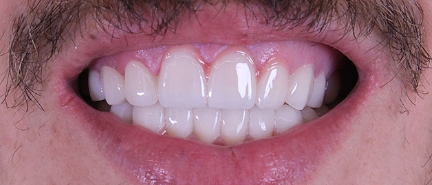 After image for selected patient