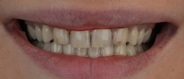 Before image for selected patient