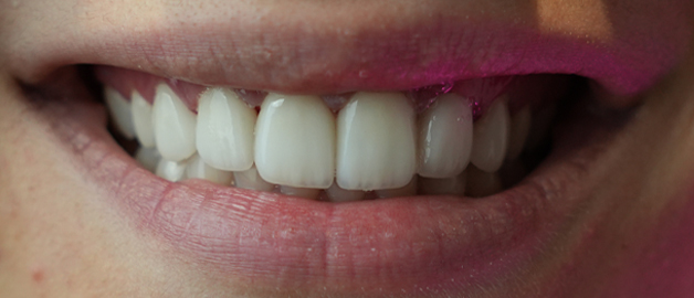 After image for selected patient