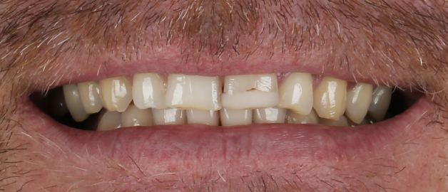 Before image for selected patient