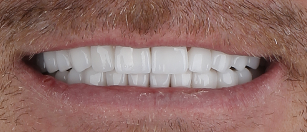 After image for selected patient