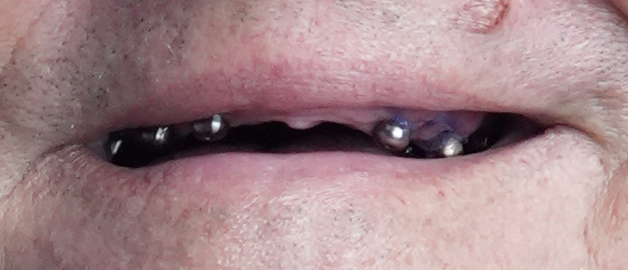 Before image for selected patient