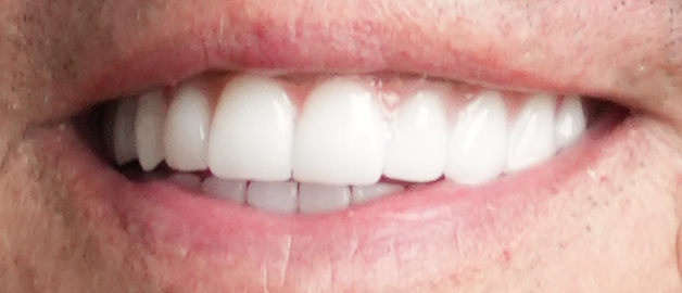 After image for selected patient