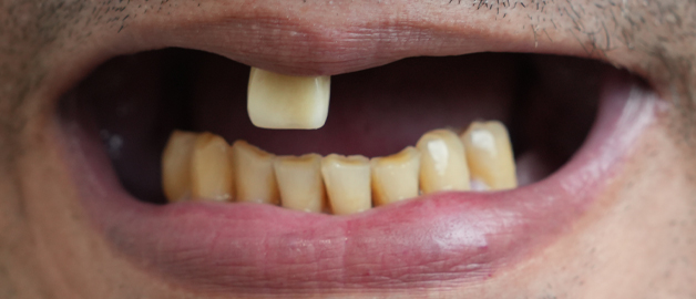 Before image for selected patient