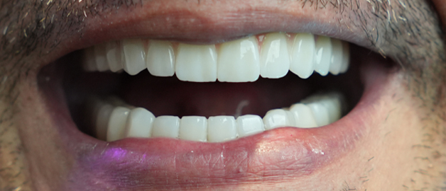 After image for selected patient