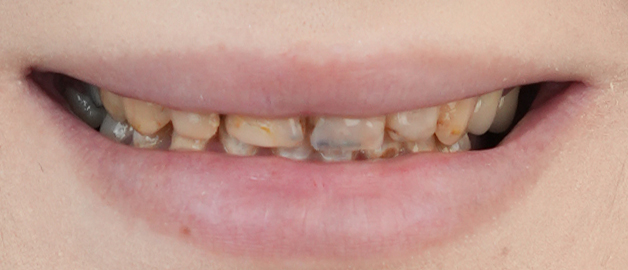 Before image for selected patient