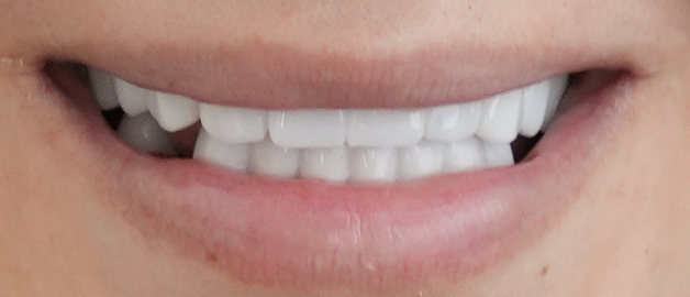 After image for selected patient