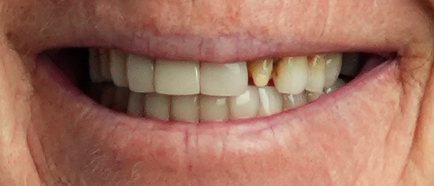 Before image for selected patient