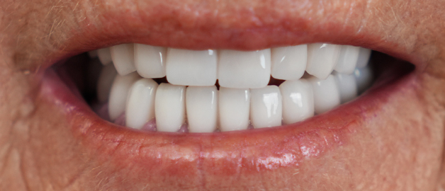 After image for selected patient