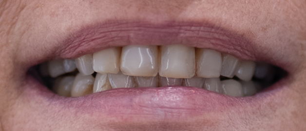 Before image for selected patient