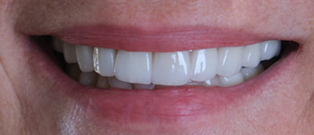 After image for selected patient