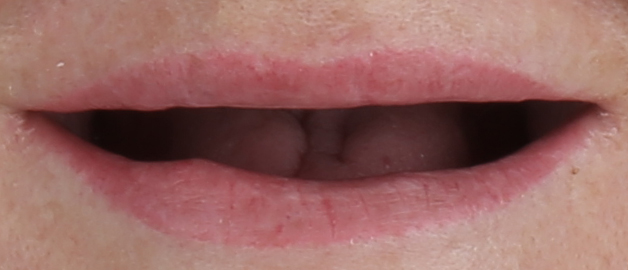 Before image for selected patient