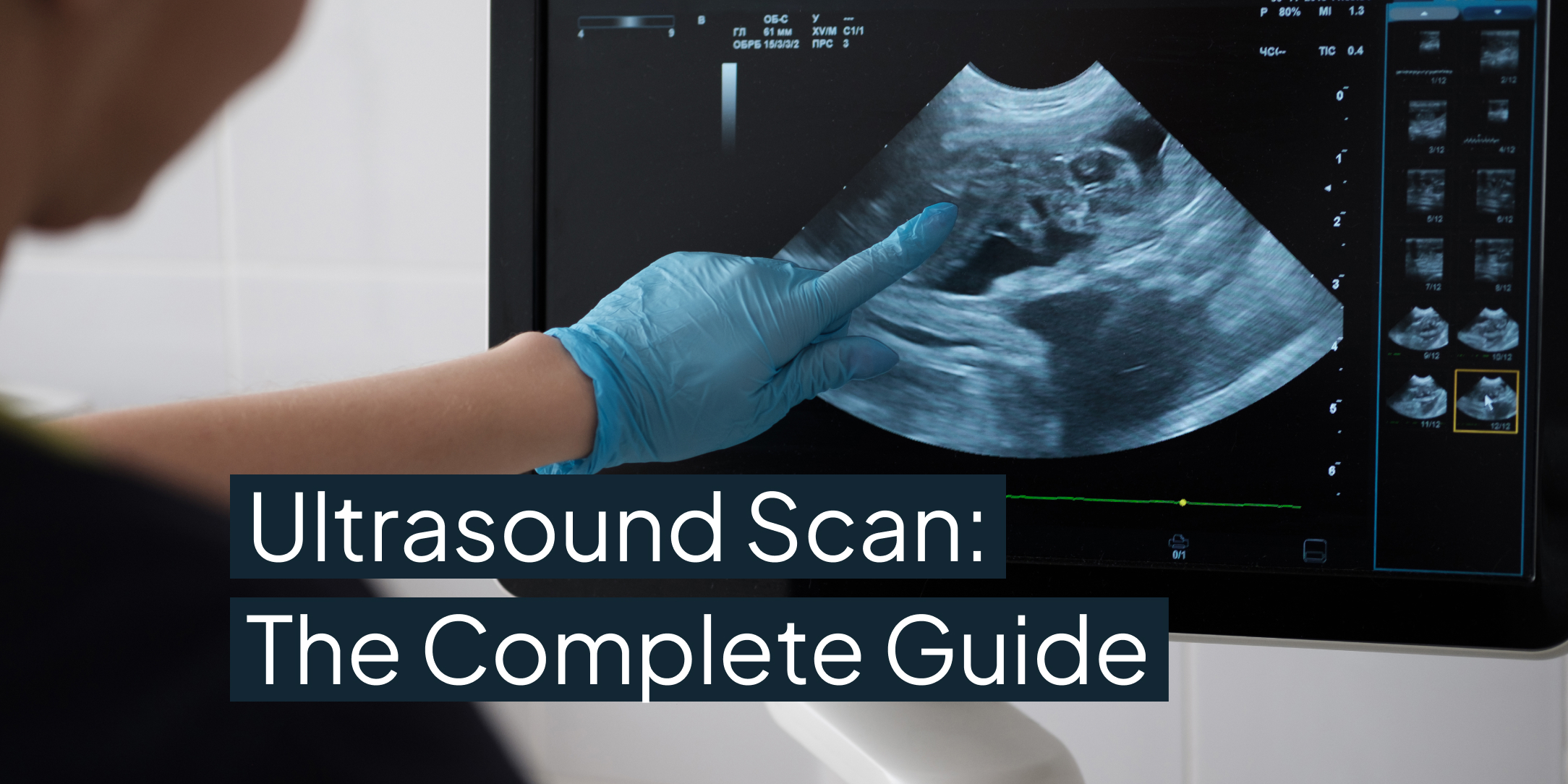 Ultrasound Scan: The Complete Guide (Updated 2025)
