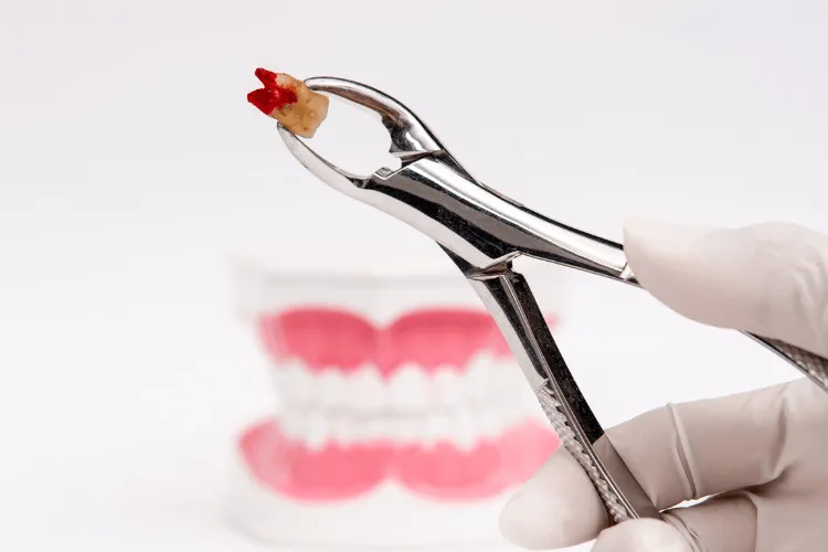 suchy-zebodol-jak-wyglada-ubytkowa-rana-po-usunieciu-zeba