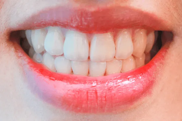 metoda-flow-injection-stomatologia