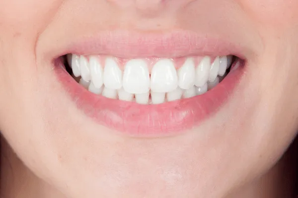 konturing-zebow-warszawa